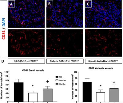 FOXO 1 deletion in chondrocytes rescues diabetes-impaired fracture healing by restoring angiogenesis and reducing apoptosis